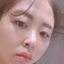 (주)나노팩인터내셔널 | 마이크로니들패치 주름개선에 사용해보니 완전 신세계