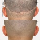 탈모왕 본점 이미지