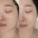양현로405번길 | 성남 분당 윤곽관리 원에스테틱 리프팅케어 받은 후기
