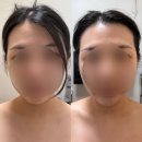 문샵 | 일산 신부관리 문샵스킨앤바디 프리미엄 리프팅 케어 솔직 후기