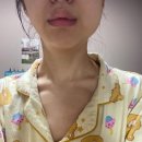 종로세브란스의원 | 신경인접 사랑니발치 | 신경 손상으로 인한 감각 이상