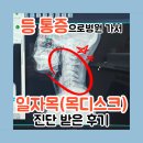서울넘버원신경외과의원 | 등 통증으로 일자목(목디스크)진단 받은 후기 (ft 개봉동 서울탑신경외과의원)