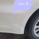 제일덴트칼라시스템 이미지
