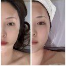양재피부관리 '끌레르에스테틱'에서 파워트리 윤곽관리 3번째 방문한 찐 만족 후기