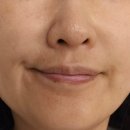 지엠메디칼 | 퓨라지엠 위치하젤 시트팩으로 모공관리 시작했어요