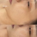 늘솜관리실 | 개신동피부관리실 늘솜스킨 미백케어 후기