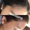 권헤어라인
