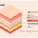 샤르네글렌티