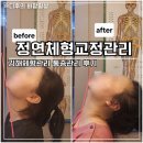 정연 | 김해체형교정 정연체형교정관리 후기
