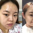 르네셀피부샵