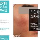 리연한의원 네이버블로그