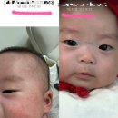 전라위생 | 소아과의사도 추천하는 아기피부템,태열 침독 잡는 닥터더마퍼트 전라인 내돈내산 후기