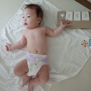 유엔비외과의원 | [육아일기] 5개월, 탈장 검사, 서울형 키즈카페 방문