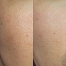 이케이헬스케어 | 진주 피부관리 에스테틱 추천