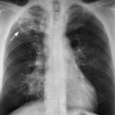 안양어린이집 이미지