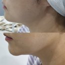 어반로지 | 얼굴 윤곽관리 잘하는 곳 어반로지 후기!