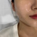 천안 청당동 피부관리 샵 메이비유에스테틱 물방울리프팅 후기
