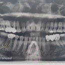 힘플란트치과의원 이미지