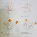 다리가 삐었을때 응급처치방법 이미지