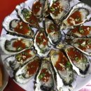 이경태정형외과의원 | 부주상골증후군 수술 후기 - by. 이경태 정형외과