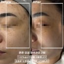 리파인스킨케어