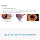 블루웰 Daum카페