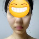 투비라인뷰티 | 홀드랩 써마3 내돈내산 팩트체크, 부위별 사용으로 얼굴 비대칭 교정 도전기