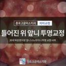 연세나노치과의원 네이버블로그