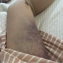 목동제일여성병원 | 목동제일여성병원 제왕절개 출산후기(5박 6일), 조현정원장님, 제왕절개 후 외래진료