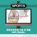 포항제이케이(JK)한방병원 | [향남재활PT] 전방십자인대 수술 후 재활 후기 - 박스점프