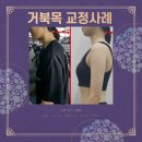 하루, 50분 | 청라1동 PT | 하루50분PT&amp;필라테스의 거북목 개선 후기