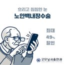 노안백내장수술 잘하는곳 이미지