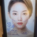 목은빌딩 | 신논현피부과 요즘핫한 세르프리프팅 효과 후기 싹 풀어드립니다