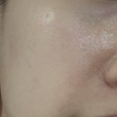 퍼스트메디 | 속건조 잡는 메디테라피 히알루론산 스킨 부스터 퍼스트 세럼