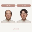모모프레 | 서울 강남구 대치동 탈모관리 모모 프레 위치 가격 후기