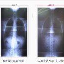 인천허리디스크 어떤치료가 좋은지 모르나요?