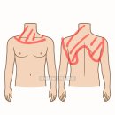유당한의원 | 피부 가려움 변색 이유 모를 소양증 수액 주사 치료 후기 내돈내산