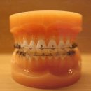 바른임플치과의원 이미지