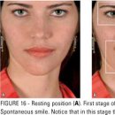 뒤센스마일 이미지