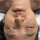 힐링헴프 | 신도림 피부관리 추천! 윤곽 두피까지 한 번에, 비욘더에서 새해 피부관리 시작한 후기