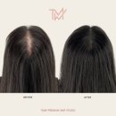 탈모왕수원
