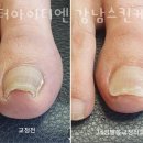 강남스킨케어