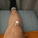 청주나비솔한방병원 | 교통사고 입원 후기 – 나비솔한방병원에서 3박 2일 입원하고 온 소감