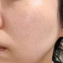 서하뷰티 | 오송 피부관리 서하뷰티 수분진정 모공관리 후기