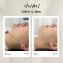 효주뷰티샵 | 부천피부관리 고주파리프팅 윤곽관리 써니뷰티 스킨디자이너 효주