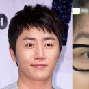 홍진호, 얼굴 변화와 눈매 변화에 대한 솔직한 고백 이미지