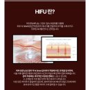 가꾸다 - 원주시 | [대구동성로] 피부 리프팅 가꾸다에서 받은 더마 리프핏 후기