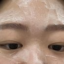 봉암중앙의원 네이버블로그