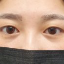 야시손톱 이미지