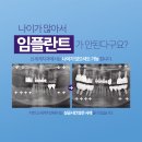 네오덴트치과기공소 | 주례치과 주례신세계치과 나이가 많아 임플란트를 망설이신다면?